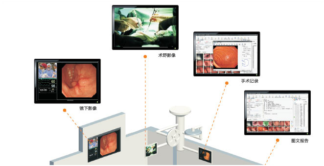内镜工作站网络版